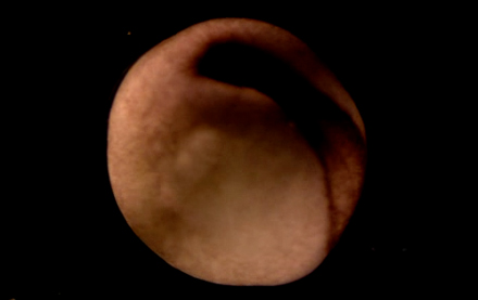 A <i>Hemidactylium scutatum</i> embryo neurulates and begins to form somites and the head.